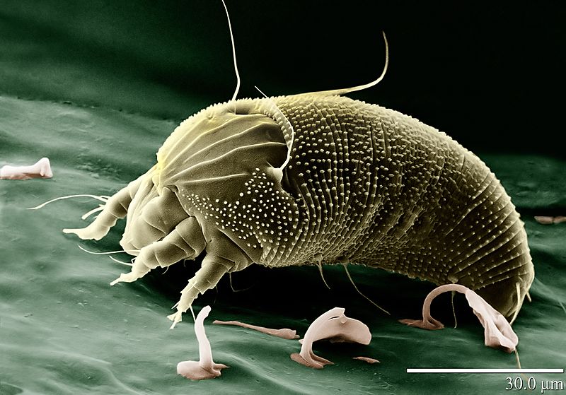 800px-Rust_Mite%2C_Aceria_anthocoptes.jpg