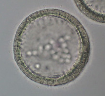 Blastula.jpg