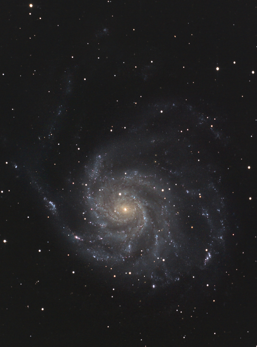 M101crop_lumbal.jpg