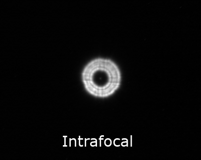 intrafocal1r.jpg